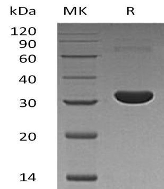 Human PBLD/MAWBP Recombinant Protein (RPES1314)