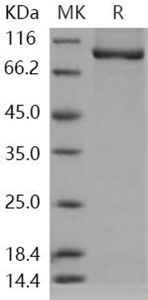 AGO3/Argonaute 3/EIF2C3 Recombinant Protein (RPES1327)