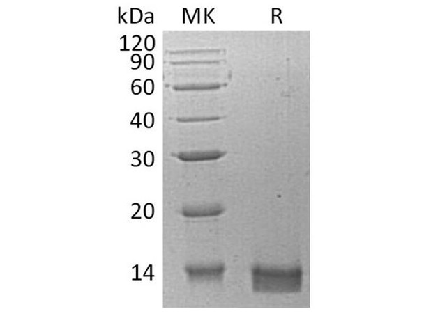 Human CXCL14 Recombinant Protein (RPES1329)