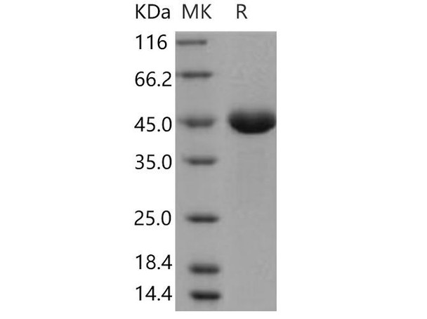 Human PGA4/Pepsinogen A Recombinant Protein (RPES1341)