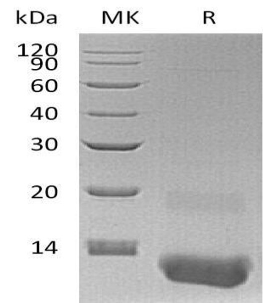 Human CXCL3/GRO gamma Recombinant Protein (RPES1348)
