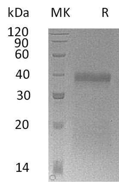 Mouse IGFBP-5/IGFBP5 Recombinant Protein (RPES1353)