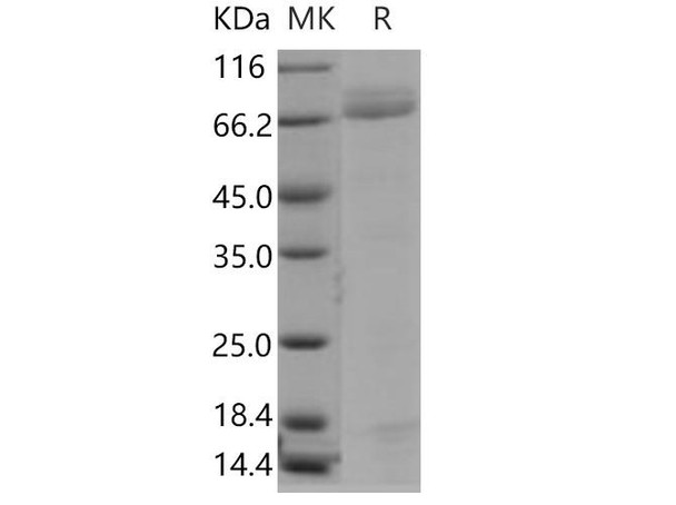 Human PGA4/Pepsinogen A Recombinant Protein (RPES1360)