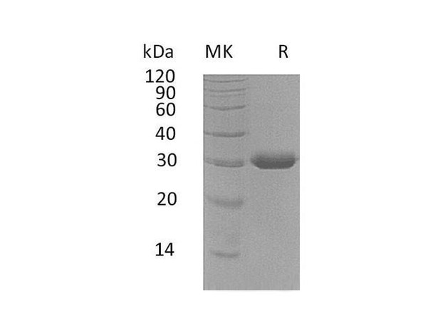 Human BTN3A3 Recombinant Protein (RPES1375)