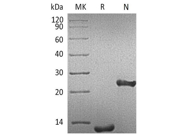 Human TGFB1/TGF-beta 1 Recombinant Protein  (RPES1385)