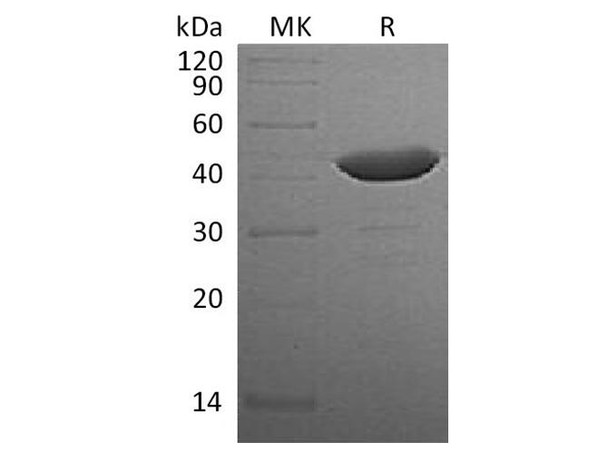 Human IDO1/IDO Recombinant Protein (RPES1387)