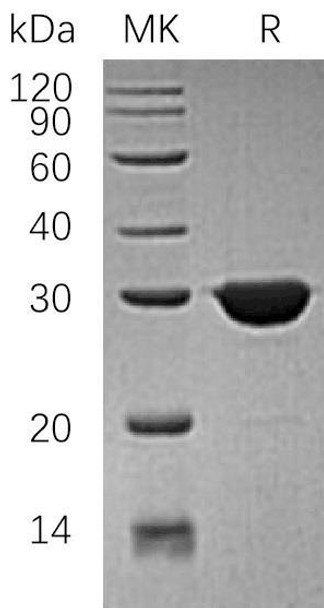 Human TPI1/TIM Recombinant Protein (RPES1389)
