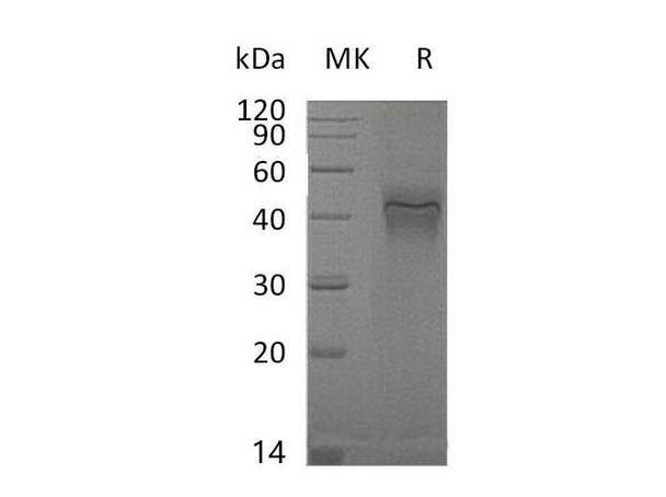 Mouse IFNGR1 Recombinant Protein (RPES1391)