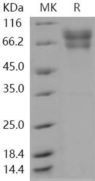 Coagulation Factor IX/F9 Recombinant Protein (RPES1399)