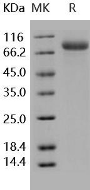 Human Endoglin/CD105 Recombinant Protein (RPES1401)