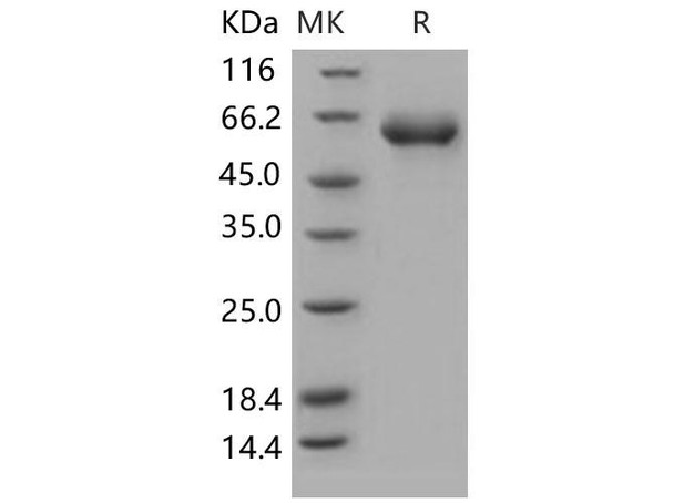 Human CD122/IL-2RB Recombinant Protein (RPES1420)