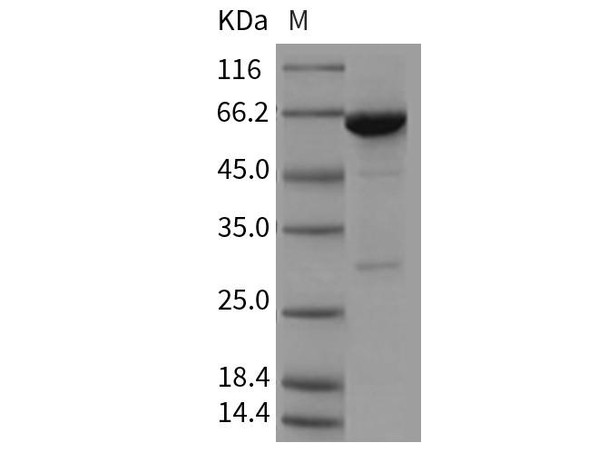 Mouse PTPN6/SH-PTP1 Recombinant Protein (RPES1430)