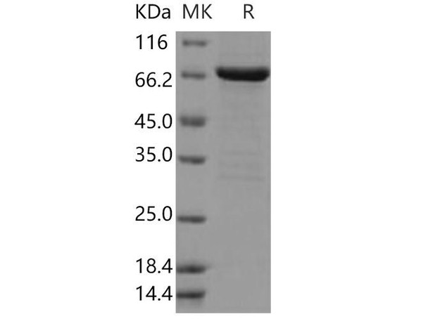 Human FGFR2/CD332 Recombinant Protein (RPES1437)