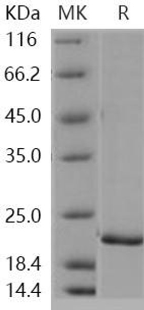 Human RHEB Recombinant Protein (RPES1442)