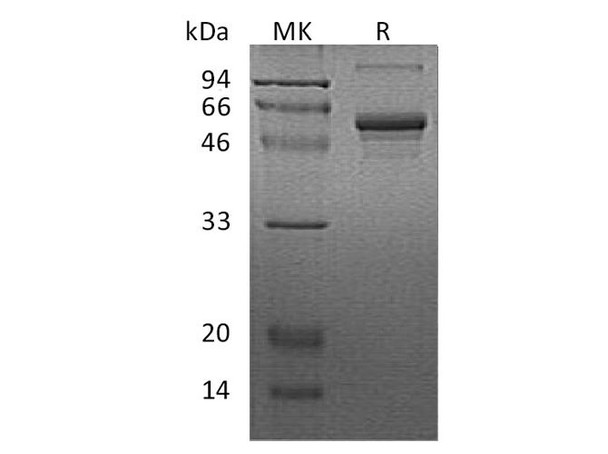 Human CSNK1G2 Recombinant Protein (RPES1443)