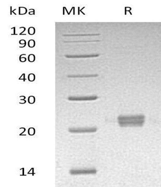Human ITPase/ITPA Recombinant Protein (RPES1445)