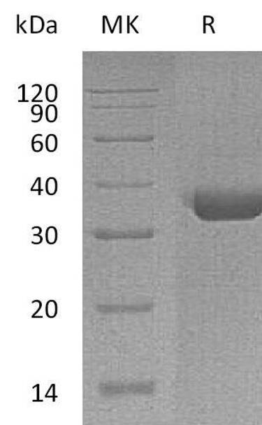 Human TPSAB1 Recombinant Protein (RPES1447)