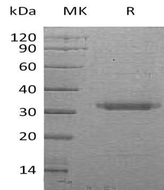 Human PRSS22/BSSP-4 Recombinant Protein (RPES1467)