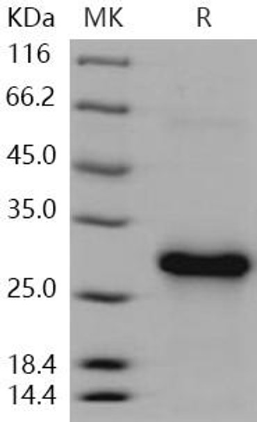 Human CLEC4A/DCIR Recombinant Protein (RPES1477)