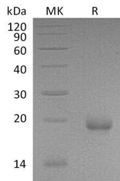 Mouse IFN-zeta/Limitin Recombinant Protein (RPES1489)