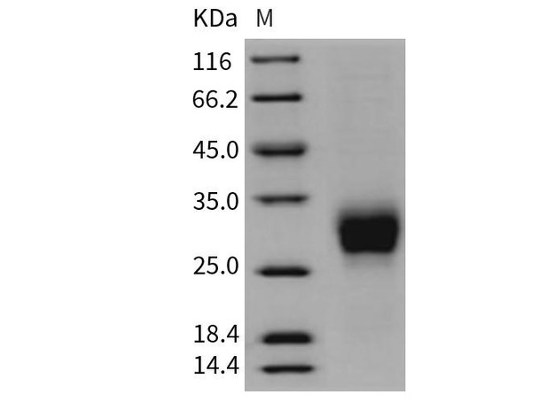 Rat CD16a/FCGR3A Recombinant Protein (RPES1500)