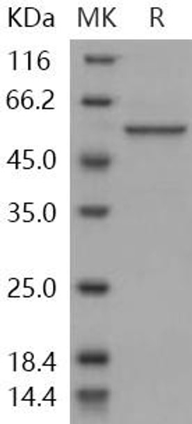 Human RBBP4/RBAP48 Recombinant Protein (RPES1502)