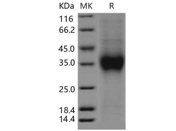 Mouse CD159a/KLRC1 Recombinant Protein (RPES1507)