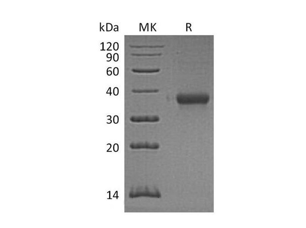 Mouse IMPAD1/IMP3 Recombinant Protein (RPES1513)