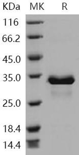 Human SULT1E1/ST1E1 Recombinant Protein (RPES1580)