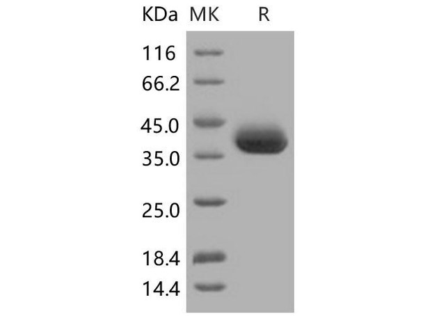 Human sFRP1/SARP2 Recombinant Protein (RPES1595)