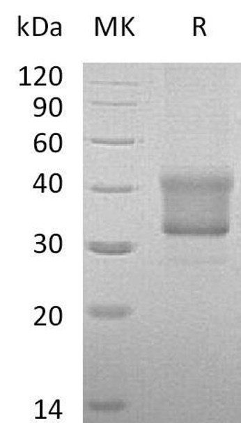 Human TNFRSF1B/CD120b Recombinant Protein (RPES1604)