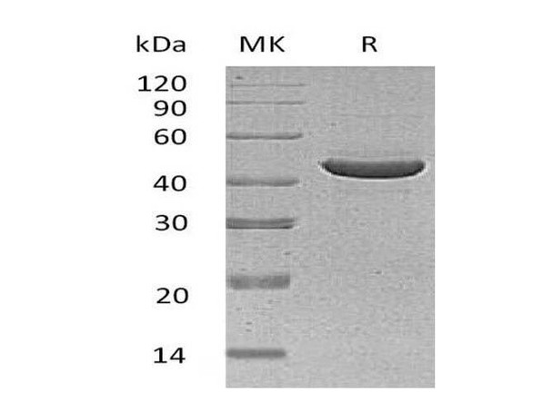 Human SerpinB3/SCCA1 Recombinant Protein (RPES1610)