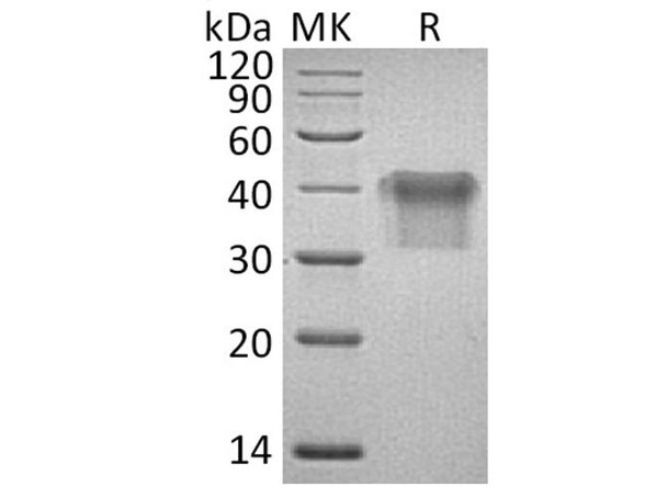 Human IL2Ra/CD25 Recombinant Protein (RPES1611)