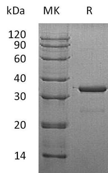 Human SULT1A3 Recombinant Protein (RPES1614)