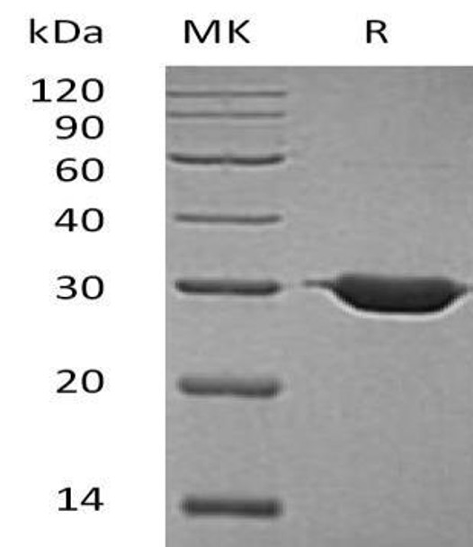 Human BDH2 Recombinant Protein (RPES1618)