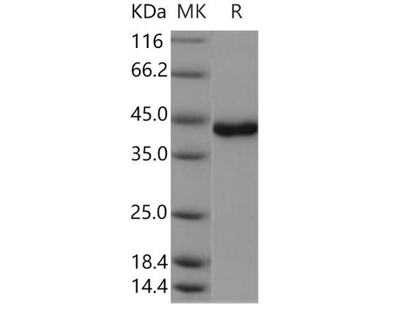 Human/Mouse USP46 Recombinant Protein (RPES1632)