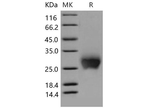 Mouse CTLA4/CD152 Recombinant Protein (RPES1637)