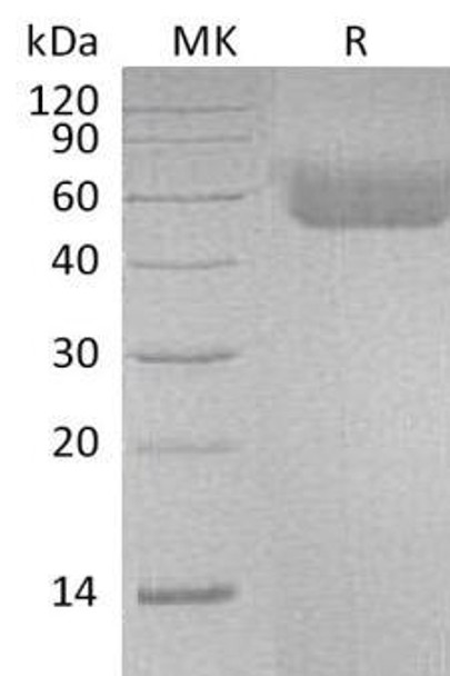 Human IL1R1/CD121a Recombinant Protein (RPES1656)