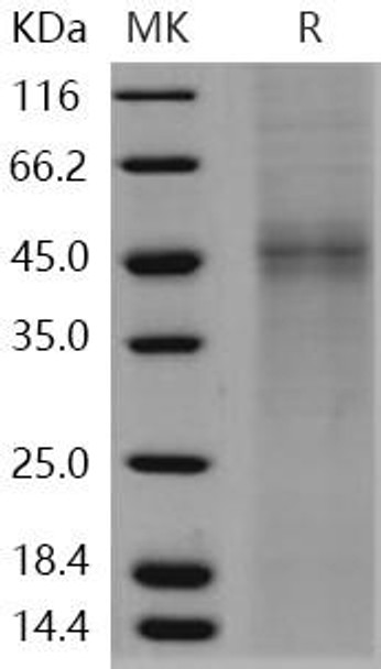Human TPST1 Recombinant Protein (RPES1659)