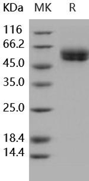 Human IL1R1/CD121a Recombinant Protein (RPES1676)