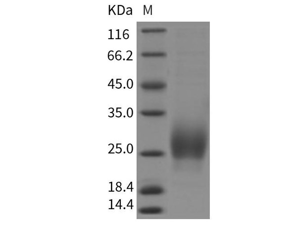 Rat CTLA-4/CD152 Recombinant Protein (RPES1677)