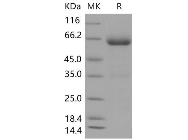 Mouse B7-DC/PD-L2/CD273 Recombinant Protein (RPES1685)