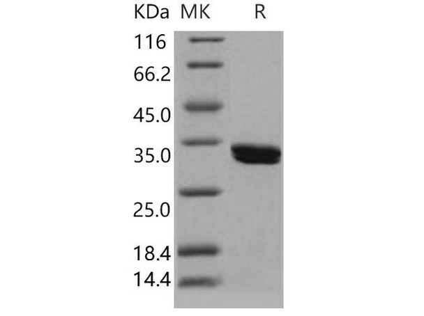 Human CDK2 Recombinant Protein (RPES1696)