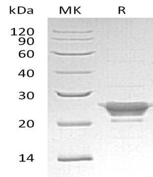 Human Peroxiredoxin-3/PRDX3 Recombinant Protein (RPES1703)