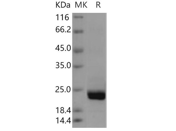 Human PTPMT1 Recombinant Protein (RPES1713)