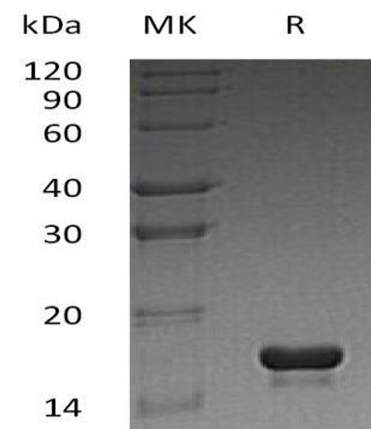 Human Cystatin C/CST3 Recombinant Protein (RPES1721)