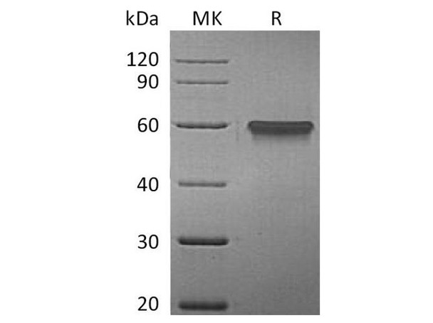 Human 4BB/TNFRSF9 Recombinant Protein (RPES1739)