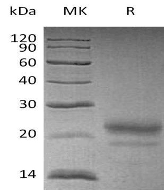 Human Cystatin 7/CST7 Recombinant Protein (RPES1740)