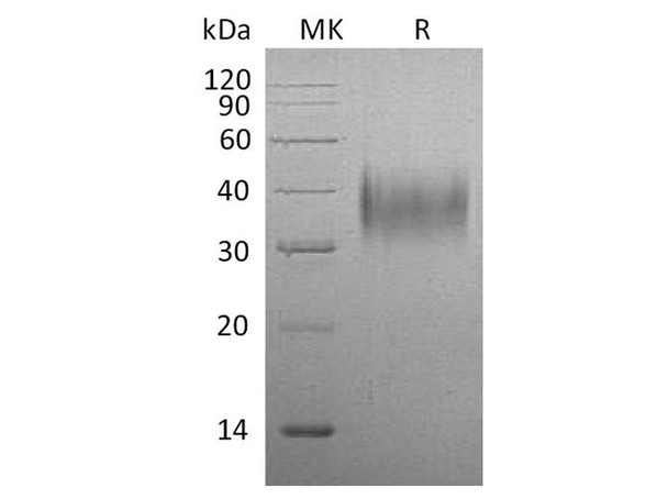 Mouse CD16/FCGR3 Recombinant Protein (RPES1751)
