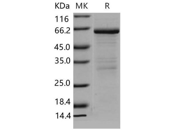 Mouse MMP8/CLG1 Recombinant Protein (RPES1758)